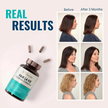 Hair La Vie Clinical Formula Hair Growth Supplement 90 Capsules | Live Conscious Hair Vitamins for Stronger, Thicker &amp; Healthier Hair